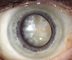 Fachpraxis für Augenheilkunde - Augenarzt Uslar